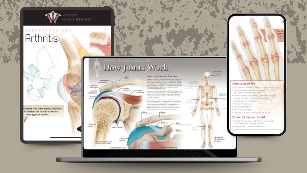 Understanding Arthritis - eBook