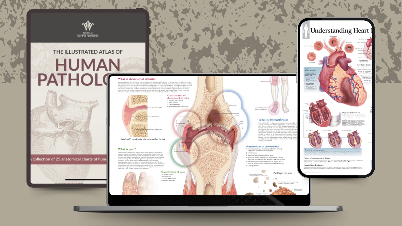 Illustrated Atlas of Human Pathology - eBook